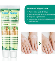 Sumifun Vitiligo Cream