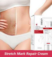 Efero Stretch Mark Repair Cream