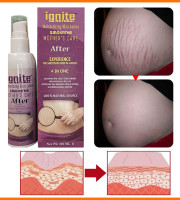 Ignite Mother Care Lotion