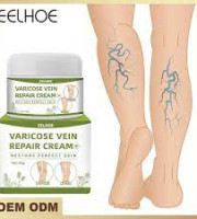 Varicose Vein Repair Cream