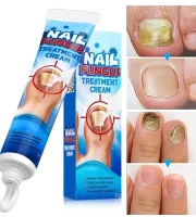 Nail Repair Gel Fungus Cream