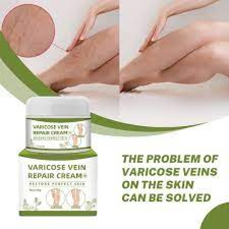 Varicose Veins Cream