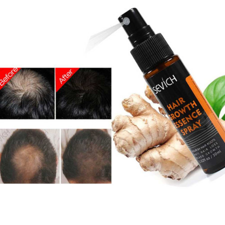 Sevich 30ml Plants Essence Hair Growth Spray