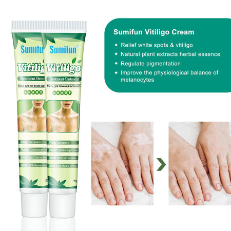 Sumifun Vitiligo Cream