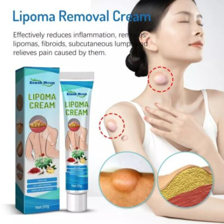 Lipoma Removal Cream-লাইপোমা রিমুভাল ক্রিম
