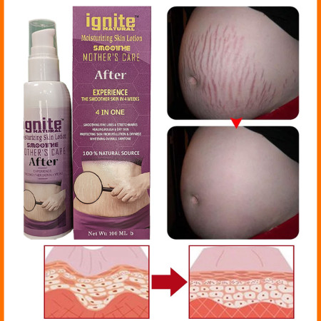 Ignite Mother Care Lotion