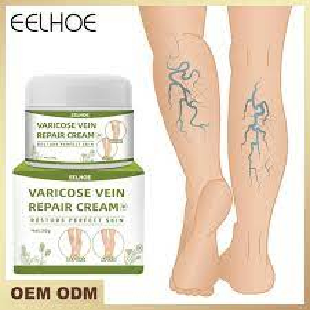 Varicose Vein Repair Cream