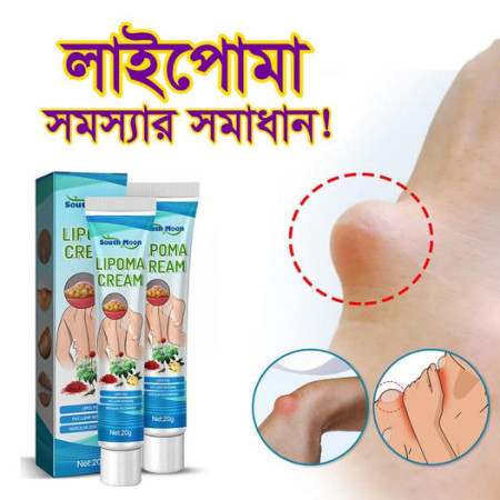 Lipoma Removal Cream