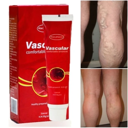 Vascular Comfortable Ointment